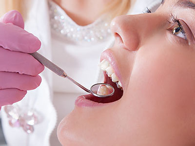 Pioneer Dentistry | Sports Mouthguards, Oral Cancer Screening and Veneers